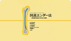 ＜書籍＞図説エンダー法 受付